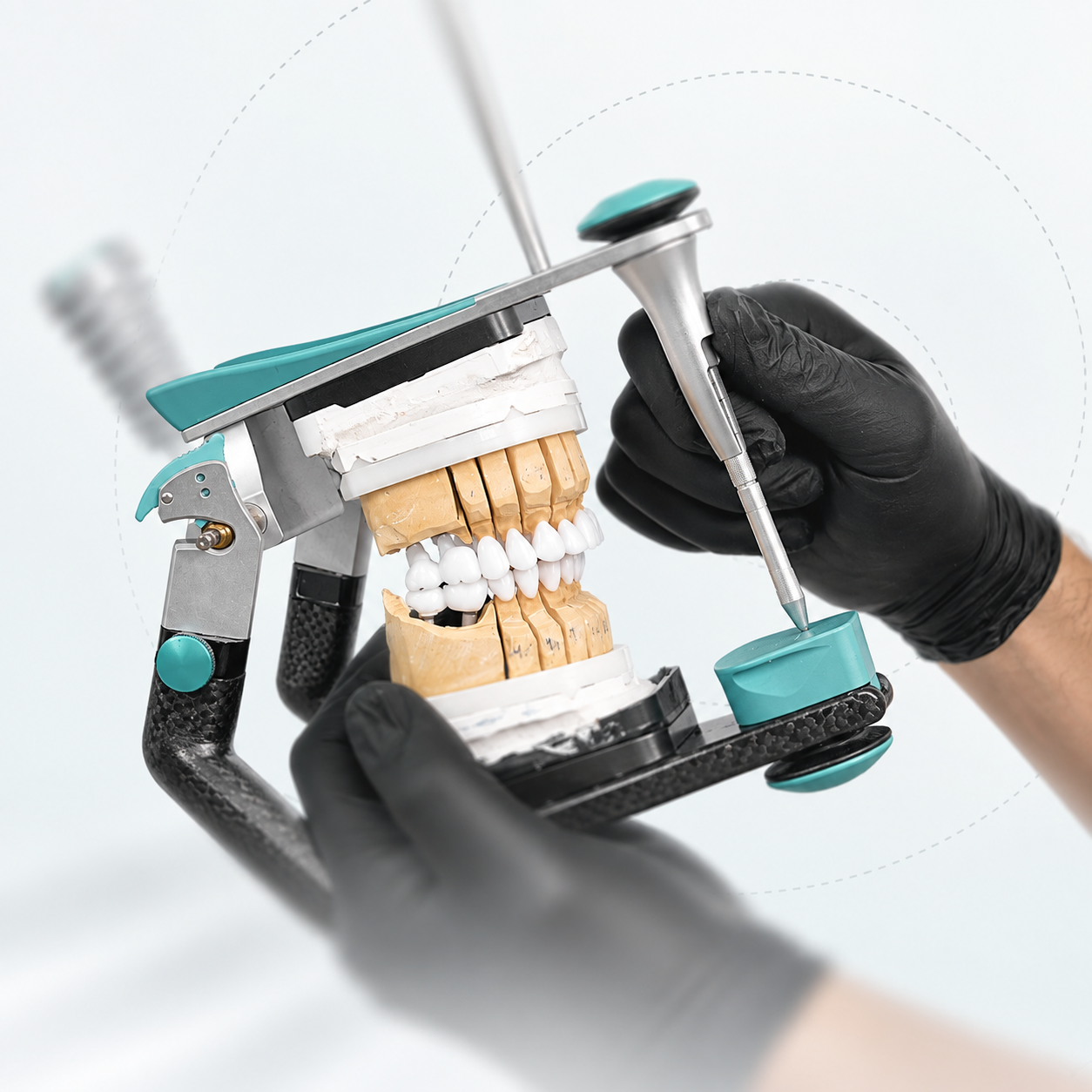 Высокое качество лечения в клинике Denty